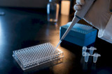 Aide protocole ELISA : le guide sandwich pas à pas