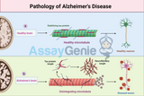 Alzheimer's Disease: A Comprehensive Insight