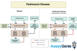 Understanding Parkinson's Disease: Insights and Innovations