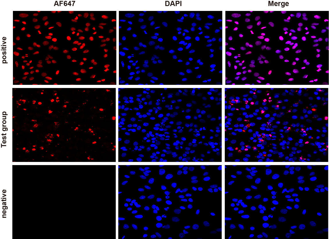 TUNEL Apoptosis Assay Kit (HRPDAB) Assay Genie