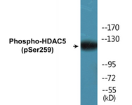 Epigenetics and Nuclear Signaling