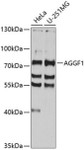 Cardiovascular Antibodies