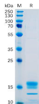 Human GITR Ligand Recombinant Protein His Tag HDPT0090 Human GITR Ligand Recombinant Protein His Tag HDPT0090