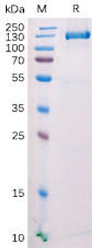 Mouse FAP Recombinant Protein C-mFc Tag HDPT0159