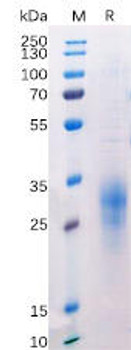 Human BTLA Recombinant Protein His Tag HDPT0174