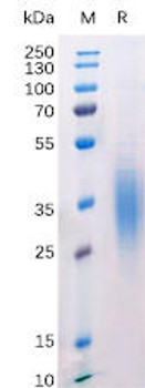 Mouse BTLA Recombinant Protein His Tag HDPT0176