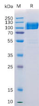 Human AXL Recombinant Protein hFc Tag HDPT0179