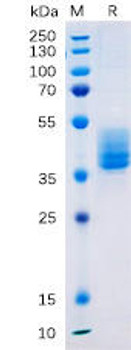 Human TM4SF1 Recombinant Protein hFc Tag HDPT0185