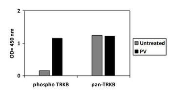 Human Phospho-TrkB Y816 and Total TrkB PharmaGenie ELISA Kit SBRS2006