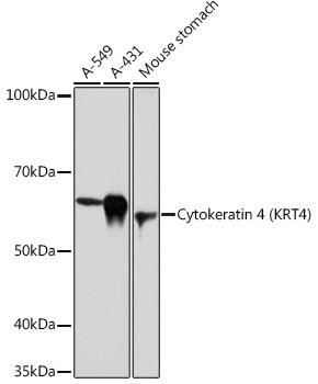 Anti-Cytokeratin 4 KRT4 Antibody CAB0013