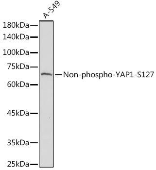 Anti-Non-phospho-YAP1-S127 Antibody CAB20250