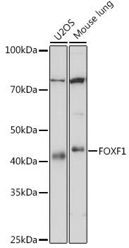 Anti-FOXF1 Antibody CAB6513