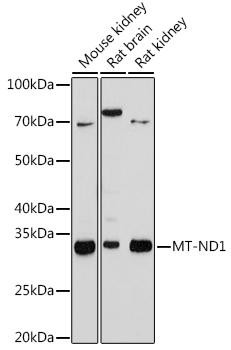 Anti-MT-ND1 Antibody CAB9743