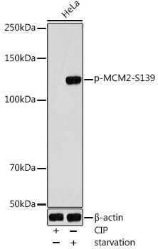 Anti-Phospho-MCM2-S139 Antibody CABP1192