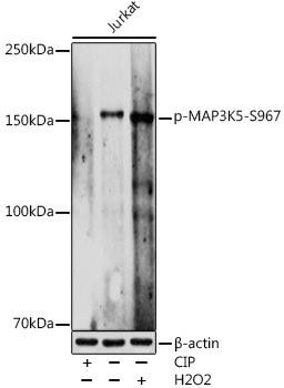 Anti-Phospho-MAP3K5-S967 Antibody CABP1217