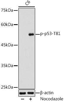 Anti-Phospho-p53-T81 Antibody CABP1253
