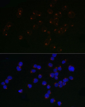Immunofluorescence analysis of Jurkat cells using ARFRP1 / ARP Rabbit mAb at dilution of 1:50 (40x lens). Blue: DAPI for nuclear staining.