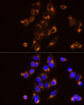 Immunofluorescence analysis of MCF7 cells using [KO Validated] AK2 Rabbit mAb at dilution of 1:25 (40x lens). Blue: DAPI for nuclear staining.