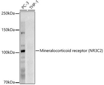 Western blot analysis of extracts of various cell lines, using Mineralocorticoid receptor (NR3C2) antibody at 1:1000 dilution. Secondary antibody: HRP Goat Anti-Rabbit IgG (H+L) at 1:10000 dilution. Lysates/proteins: 25ug per lane. Blocking buffer: 3% nonfat dry milk in TBST. Detection: ECL Enhanced Kit. Exposure time: 180s.