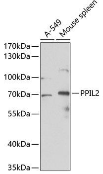Western blot analysis of extracts of various cell lines, using PPIL2 antibody at 1:1000 dilution. Secondary antibody: HRP Goat Anti-Rabbit IgG (H+L) at 1:10000 dilution. Lysates/proteins: 25ug per lane. Blocking buffer: 3% nonfat dry milk in TBST. Detection: ECL Basic Kit. Exposure time: 30s.