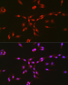 Immunofluorescence analysis of PC-12 cells using TAF15 antibody at dilution of 1:25. Blue: DAPI for nuclear staining.