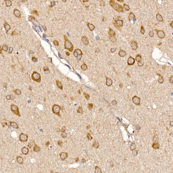 Immunohistochemistry of paraffin-embedded rat brain using ERp19 Rabbit mAb at dilution of 1:200 (40x lens). Perform high pressure antigen retrieval with 10 mM citrate buffer pH 6. 0 before commencing with IHC staining protocol.