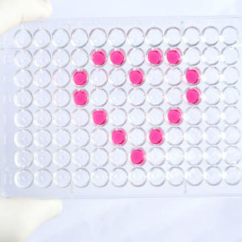 Human Immunology ELISA Kits 6 Human Breast cancer type 1 susceptibility protein BRCA1 ELISA Kit
