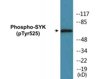 SYK Phospho-Tyr525 Colorimetric Cell-Based ELISA Kit