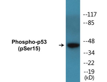 p53 Phospho-Ser15 Colorimetric Cell-Based ELISA Kit