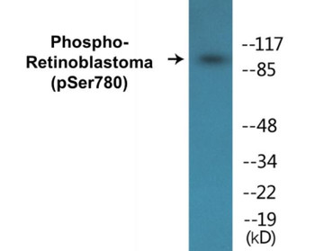 Retinoblastoma Phospho-Ser780 Colorimetric Cell-Based ELISA Kit