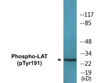 LAT Phospho-Tyr191 Colorimetric Cell-Based ELISA Kit