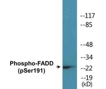 FADD Phospho-Ser191 Colorimetric Cell-Based ELISA Kit