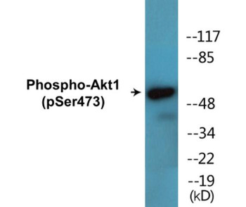 Akt1 Phospho-Ser473 Fluorometric Cell-Based ELISA Kit