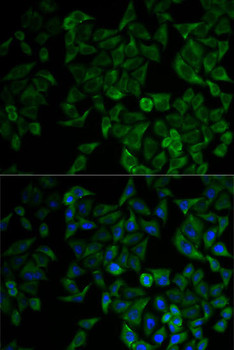 Cell Death Antibodies 1 Anti-TNFRSF1A Antibody CAB0033