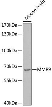 Cell Biology Antibodies 2 Anti-MMP9 Antibody CAB11391