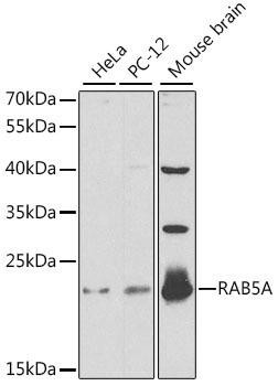 KO Validated Antibodies 1 Anti-RAB5A Antibody CAB1180KO Validated