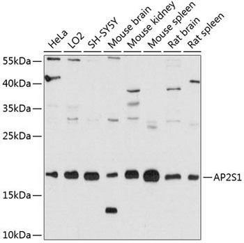 Cell Biology Antibodies 2 Anti-AP2S1 Antibody CAB12270