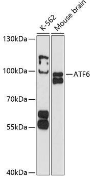 Epigenetics and Nuclear Signaling Antibodies 1 Anti-ATF6 Antibody CAB12570