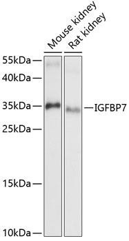 Cell Biology Antibodies 3 Anti-IGFBP7 Antibody CAB13023