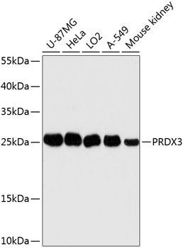 Cell Biology Antibodies 3 Anti-PRDX3 Antibody CAB13074