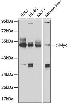 Epigenetics and Nuclear Signaling Antibodies 1 Anti-c-Myc Antibody CAB1309
