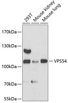 Cell Biology Antibodies 3 Anti-VPS54 Antibody CAB13215