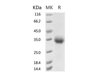 Recombinant 2019-nCoV Spike Protein RBD, His Tag