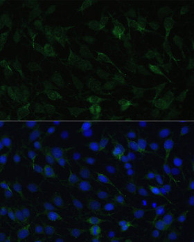 Cell Biology Antibodies 4 Anti-TAC1 Antibody CAB13550