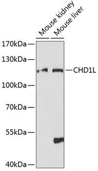 Epigenetics and Nuclear Signaling Antibodies 3 Anti-CHD1L Antibody CAB14264