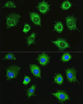 Cell Biology Antibodies 16 Anti-ZAK Antibody CAB14513