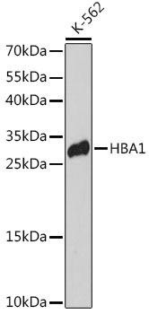 Signal Transduction Antibodies 1 Anti-HBA1 Antibody CAB14551