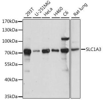 Signal Transduction Antibodies 2 Anti-SLC1A3 Antibody CAB15722