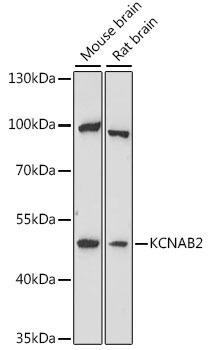 Signal Transduction Antibodies 2 Anti-KCNAB2 Antibody CAB16224
