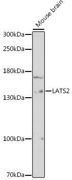 Cell Cycle Antibodies 1 Anti-LATS2 Antibody CAB16249